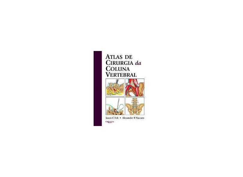 ATLAS DE CIRURGIA DA COLUNA VERTEBRAL - Eck, Jason C / Vaccaro, Alexander R - 9788580530940