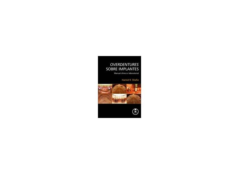Overdentures Sobre Implantes - Manual Clínico e Laboratorial - Shafie, Hamid R. - 9788536320700