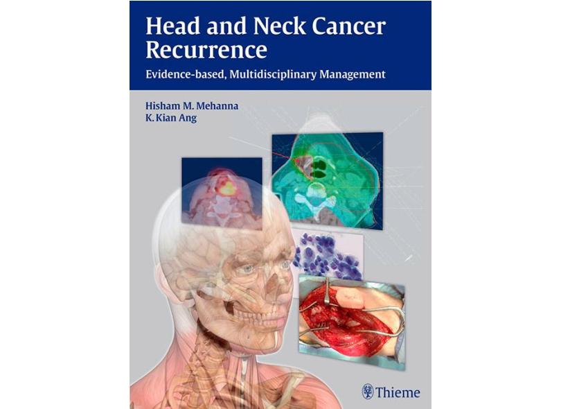 HEAD AND NECK CANCER RECURRENCE - Mehanna / Ang - 9783131473912