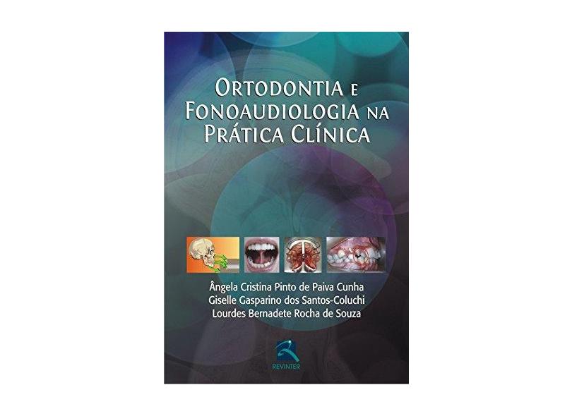 Ortodontia E Fonoaudiologia Na Prática Clinica - Capa Comum - 9788537203545