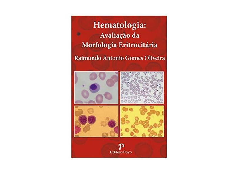 Hematologia. Avaliação Da Morfologia Eritrocitária (pranchas) - Raimundo Antonio Gomes Oliveira - 9788557950092