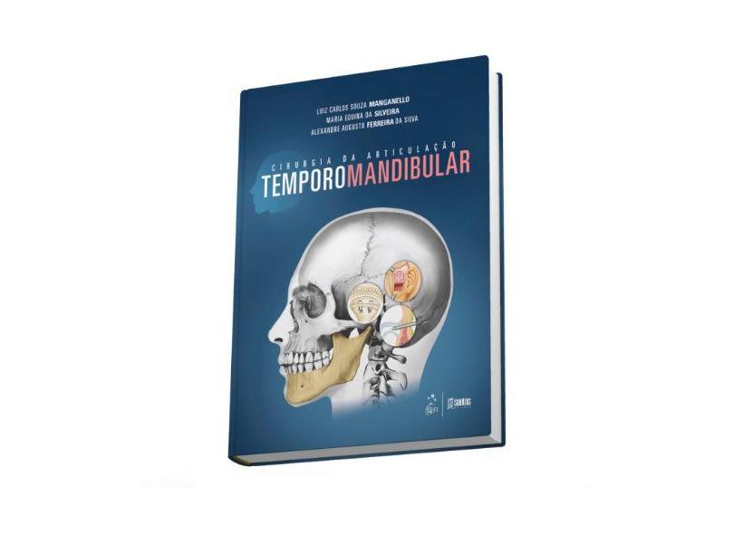 Cirurgia da Articulação Temporomandibular - Manganello, Luiz Carlos Souza; Silva, Alexandre Augusto Ferreira Da; Silveira, Maria Eduina Da - 9788541204156