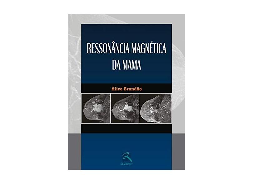 Ressonancia Magnetica Da Mama - Capa Dura - 9788537203255