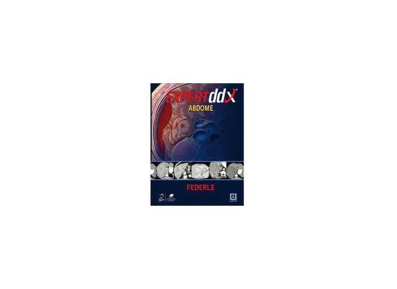 Abdome - Série Expertddx - Federle, Michael P. - 9788527716963