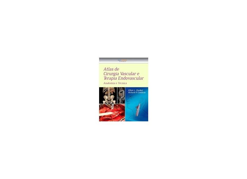 Atlas de Cirurgia Vascular e Terapia Endovascular - Richard Cambria - 9788535282801