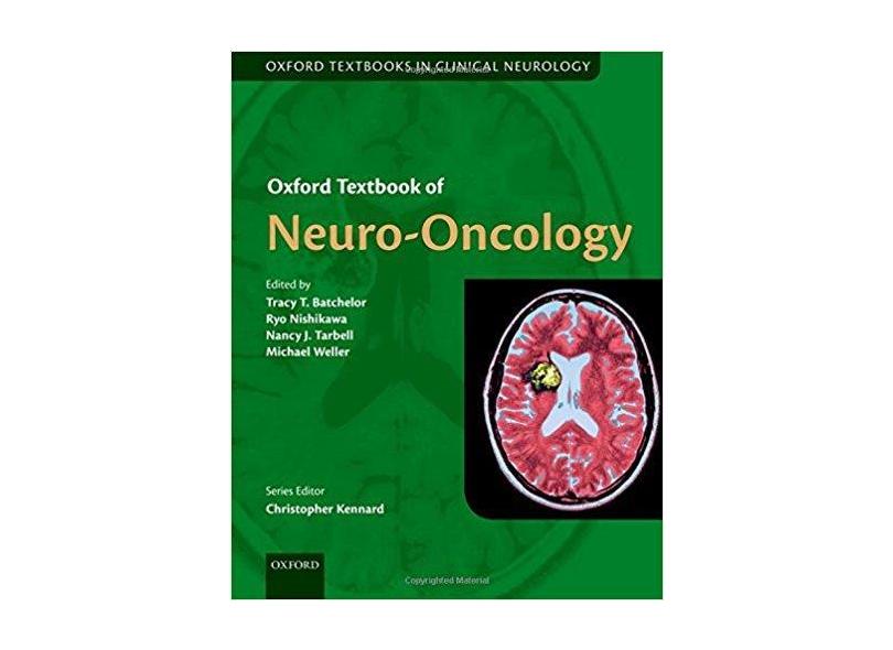 OXFORD TEXTBOOK OF NEURO-ONCOLOGY - Tracy Batchelor (editor),  Ryo Nishikawa (editor),   Nancy Tarbell (editor),   Michael Weller - 9780199651870