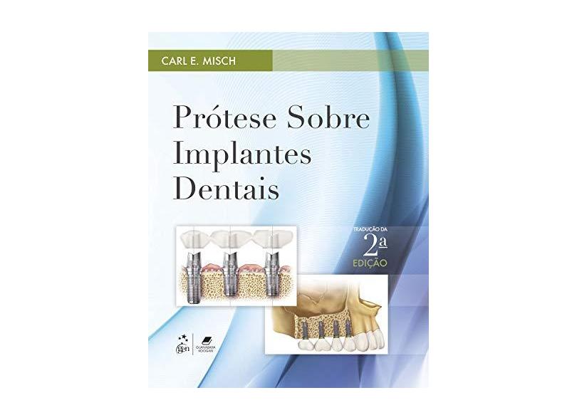 Prótese Sobre Implantes - Capa Comum - 9788535282559