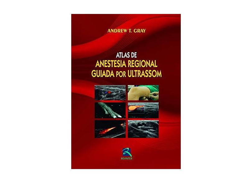 Atlas De Anestesia Regional Guiada Por Ultrassom - Capa Comum - 9788537204528