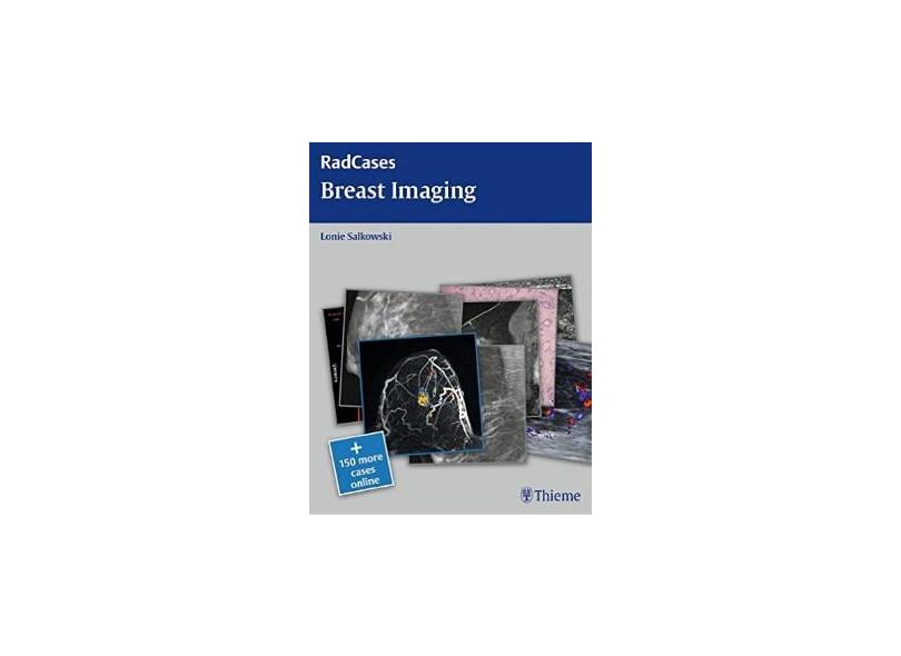 Radcases Breast Imaging - Lonie L Salkowski - 9781604061918
