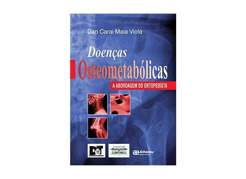 Doenças Osteometabólicas - Dan Carai Maia Viola - 9788574541150
