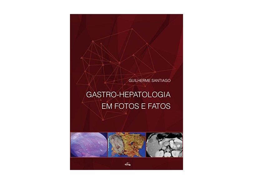 Gastro-Hepatologia Em Fotos e Fatos - Mendes, Guilherme Santiago - 9788588361805