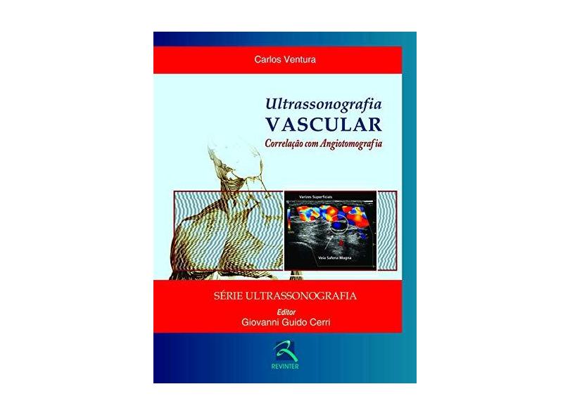Ultrassonografia Vascular. Correlação Com Angiotomografia - Capa Comum - 9788537204719
