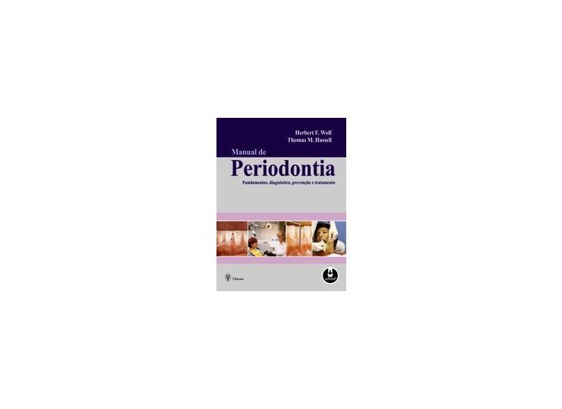 Manual de Periodontia - Fundamentos, Diagnósticos, Prevenção e Tratamento - Hassell, Thomas M.; Wolf, Herbert F. - 9788536314150