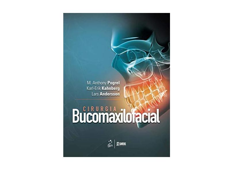 Cirurgia Bucomaxilofacial - Andersson, Lars; Kahnberg, Karl-erik; Pogrel, M. Anthony - 9788527728553