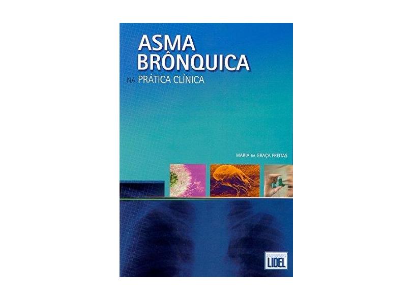 Asma Brônquica na Prática Clínica - Maria Da Graça Freitas - 9789727571963