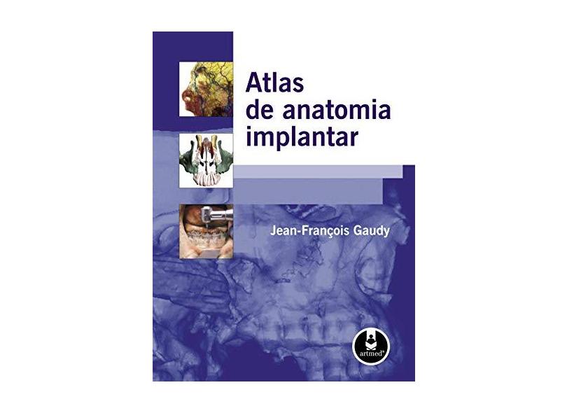 Atlas de Anatomia Implantar - Gaudy Jean-francois - 9788536316451