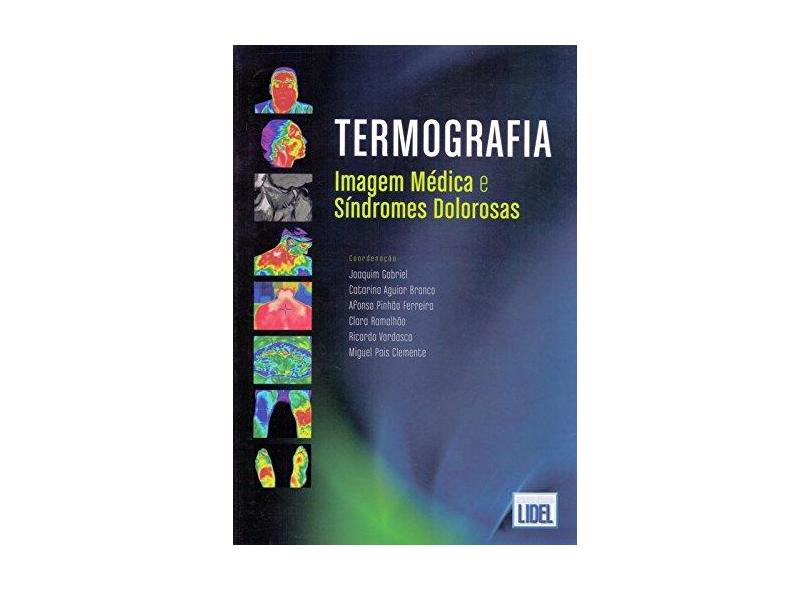 Termografia - Imagem Médica E Síndromes Dolorosas - Gabriel, Joaquim - 9789897522154