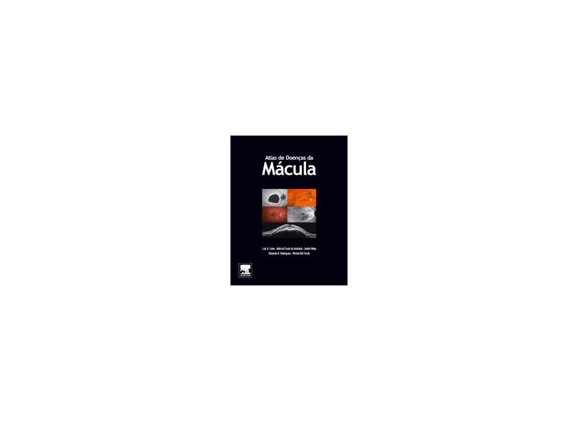 Atlas de Doenças da Mácula - Luiz H. Lima - 9788535283365