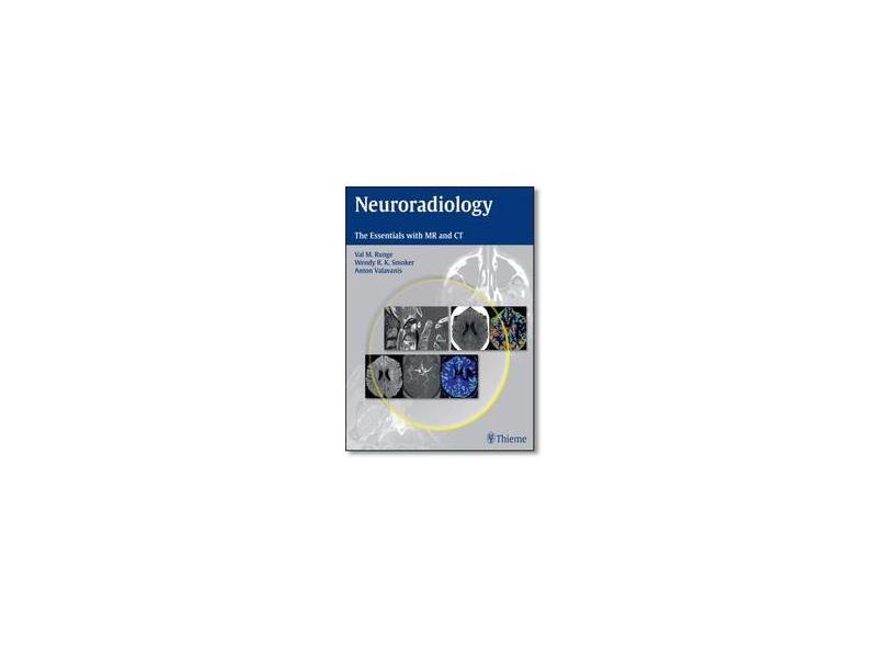 Neuroradiology: The Essentials with MR and CT - Val M Runge - 9781604069167