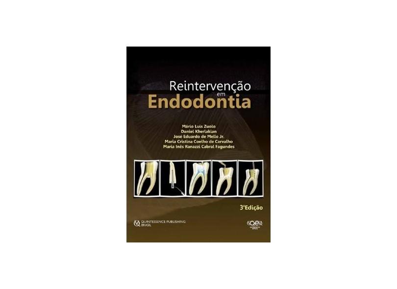REINTERVENCAO EM ENDODONTIA - Zuolo, Mario Luis - 9788578891008