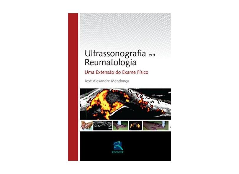 Ultrassonografia em Reumatologia - Capa Dura - 9788537205716