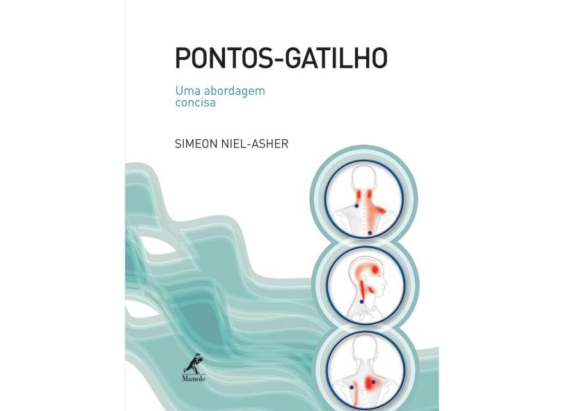 Pontos-gatilho - Uma Abordagem Concisa - Niel-asher, Simeon - 9788520426845
