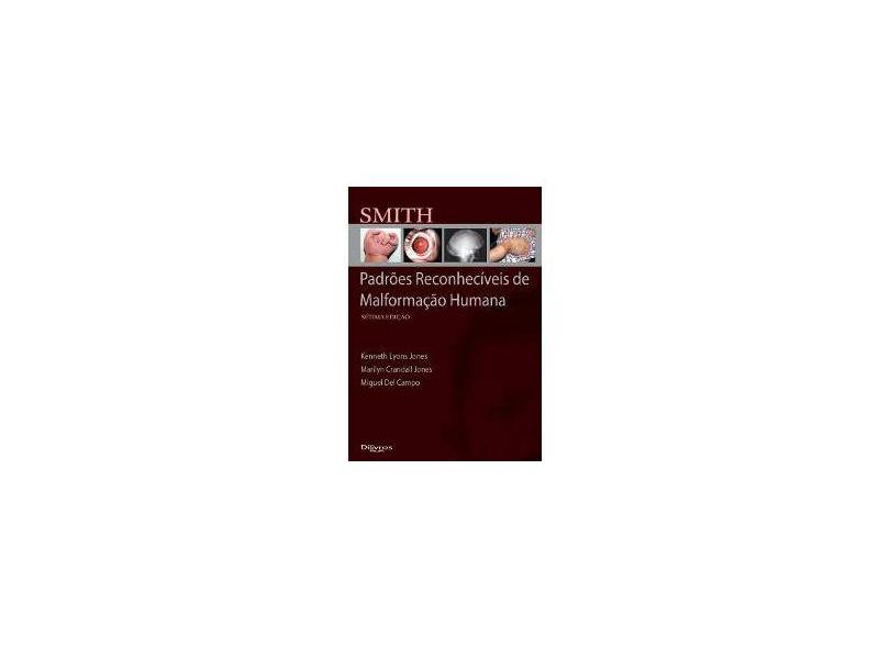 SMITH PADROES RECONHECIVEIS DE MALFORMACAO HUMANA - Jones, Kenneth Lyans / Jones, Marilyn Crandall / Campo, Migual Del - 9788580531367