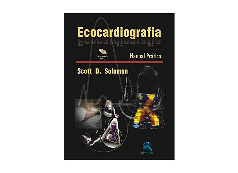Ecocardiografia. Manual Prático - Capa Comum - 9788537202937