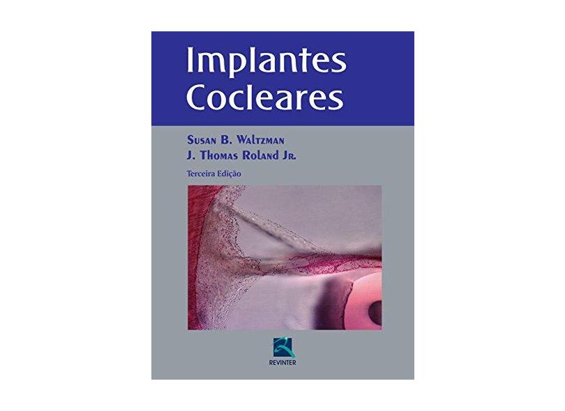 Implantes Cocleares - Susan B. Waltzman - 9788537206706