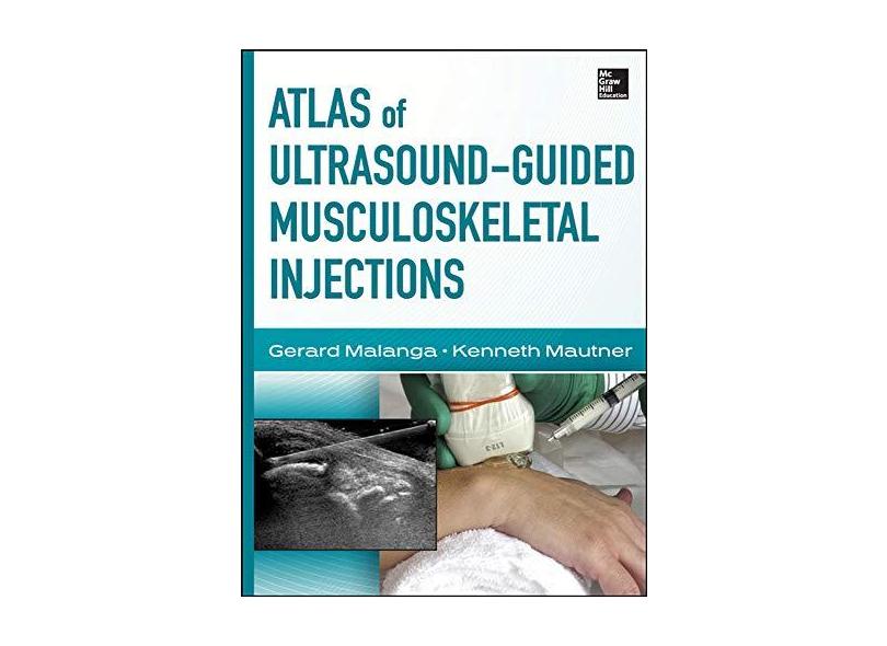 ATLAS OF ULTRASOUND-GUIDED MUSCULOSKELETAL INJECTIONS - Malanga - 9780071769679