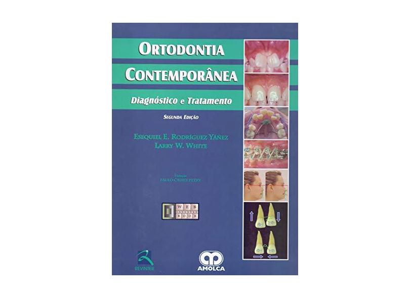 Ortodontia Contemporanea. Diagnostico E Tratamento - Capa Dura - 9788537203323