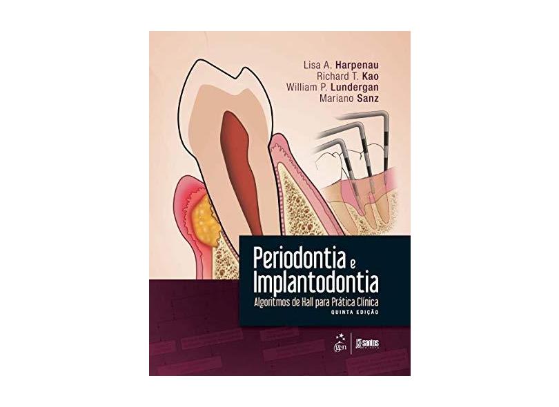 Periodontia e Implantodontia - Algoritmos de Hall Para Prática Clínica -5ª Ed. 2016 - Harpenau, Lisa A.; Kao, Richard T.; Lundergan, William P.; Sanz, Mariano - 9788527728676