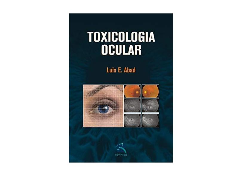 Toxologia Ocular - Capa Comum - 9788573099867
