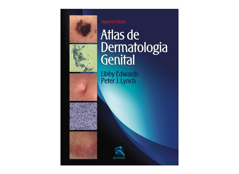 Atlas De Dermatologia Genital - Capa Comum - 9788537204177