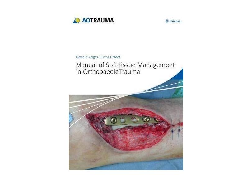 Manual of Soft-Tissue Management in Orthopaedic Trauma - David A. Volgas - 9783131663719