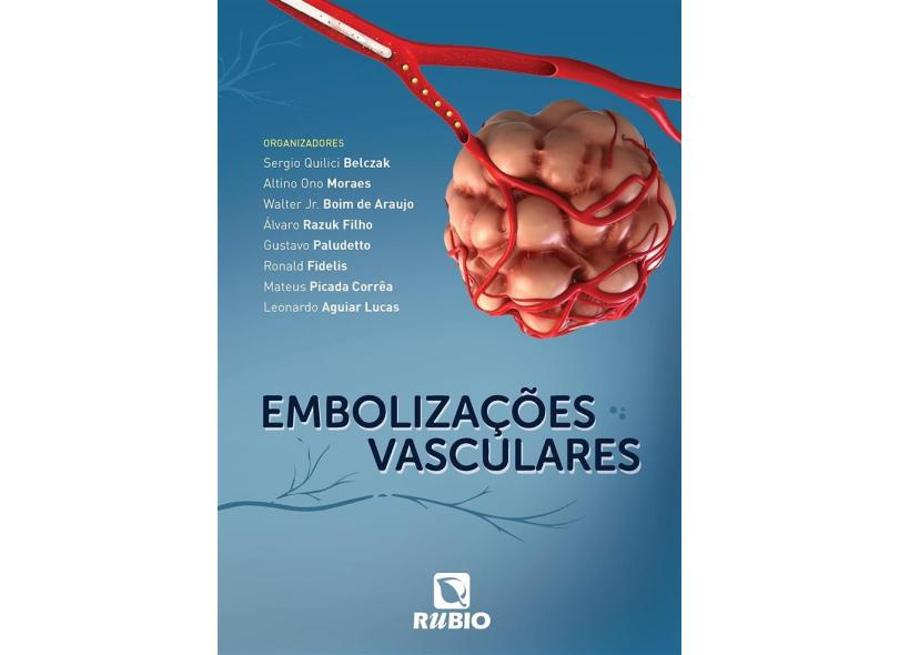 Embolizações Vasculares - Sergio Quilici Belczak - 9788584110926