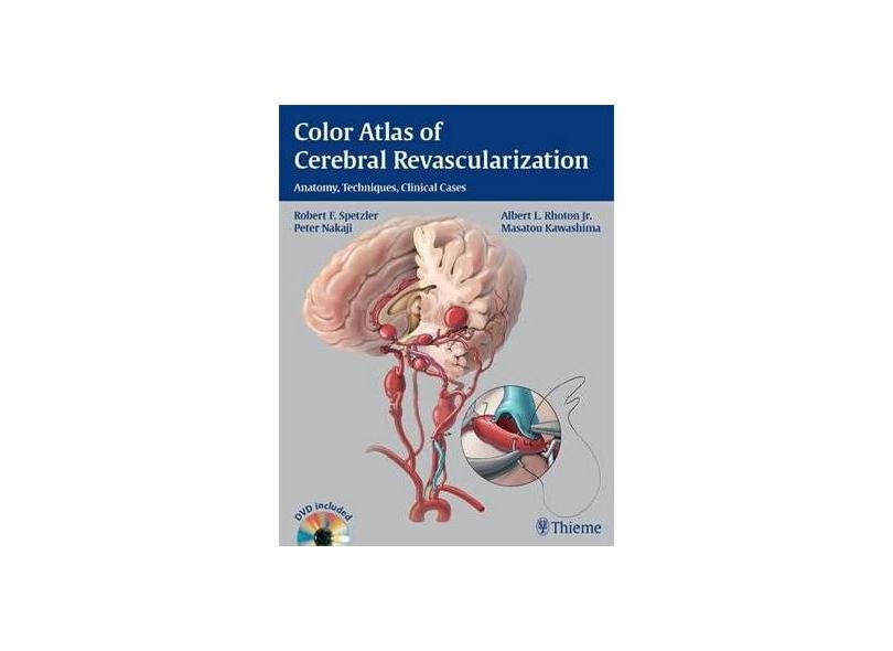 Color Atlas of Cerebral Revascularization: Anatomy, Techniques, Clinical Cases - Robert F Spetzler - 9781604068221