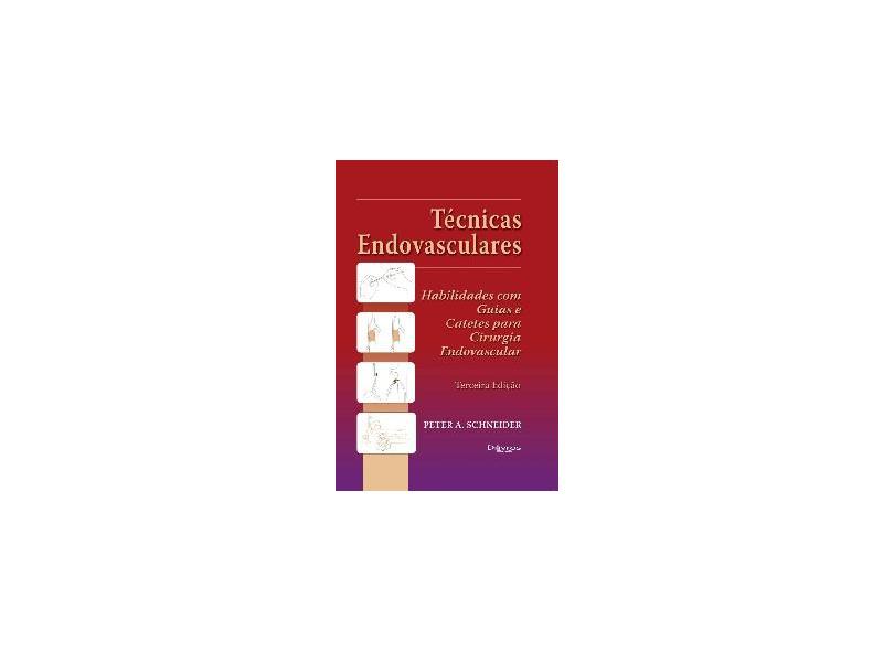 Técnicas Endovasculares - Habilidades com Guias e Catetes para Cirurgia Endovascular - Peter Schneider - 9788586703997
