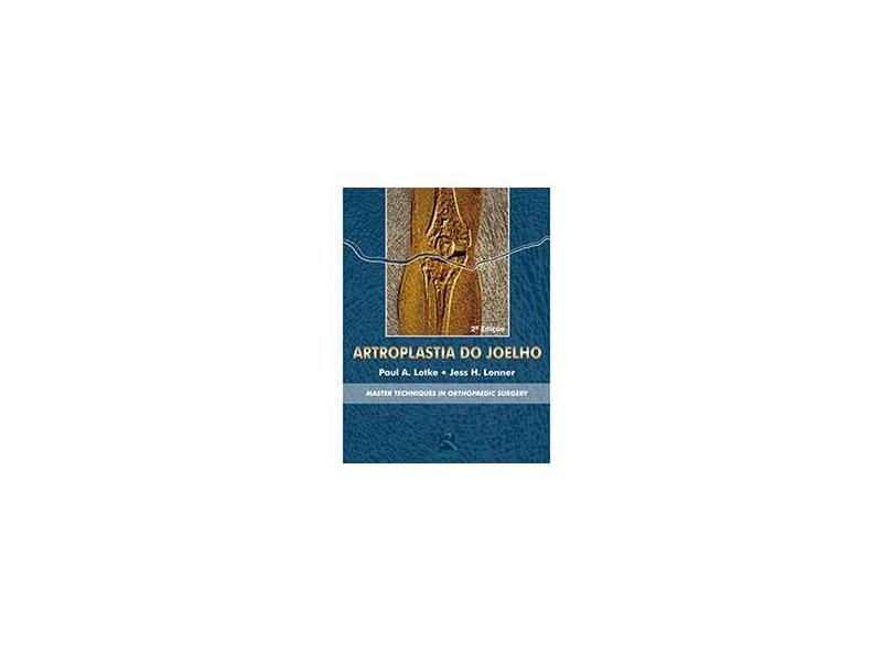 Artroplastia do Joelho: Master Techniques in Orthopaedic Surgery - Paul A. Lotke, Jess H. Lonner - 9788537200803