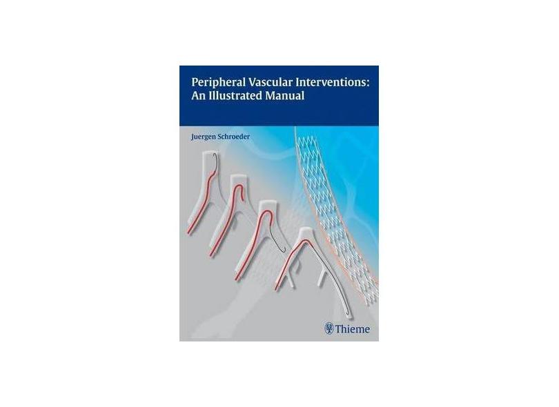PERIPHERAL VASCULAR INTERVENTIONS: AN ILLUSTRATED MANUAL - Schroeder - 9783131697516