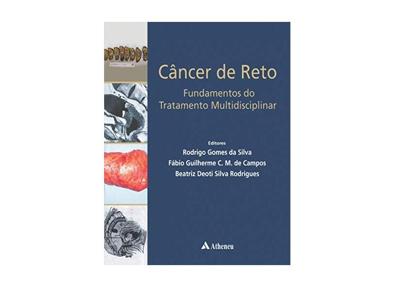 CANCER DO RETO - FUNDAMENTOS DO TRATAMENTO MULTIDISCIPLINAR - Silva, Rodrigo Gomes Da / Campos, Fabio Guilherme C. M. De / Rodrigues, Beatriz Deoti Silva - 9788538807759