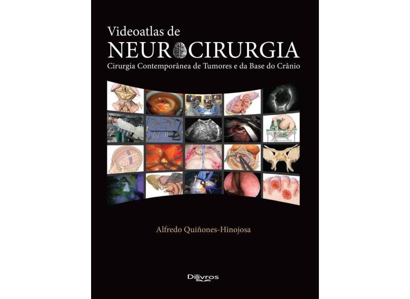 VIDEOATLAS DE NEUROCIRURGIA - Alfredo Quinones Hinojosa - 9788580531794