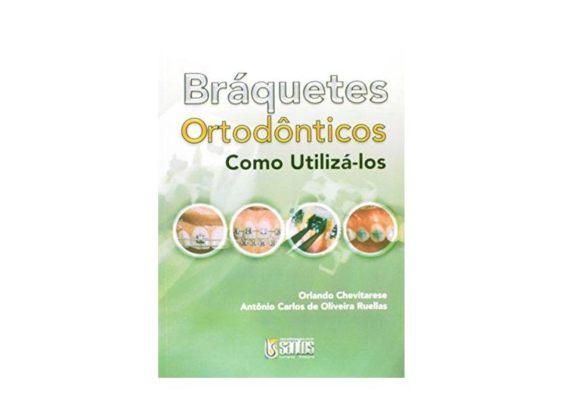 Bráquetes Ortodônticos - Como Utilizá-los - Chevitarese, O. - 9788572885058