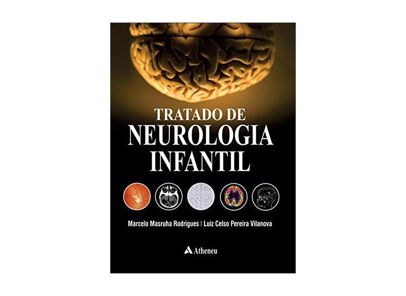 Tratado De Neurologia Infantil - Marcelo Marusha Rodrigues - 9788538807421
