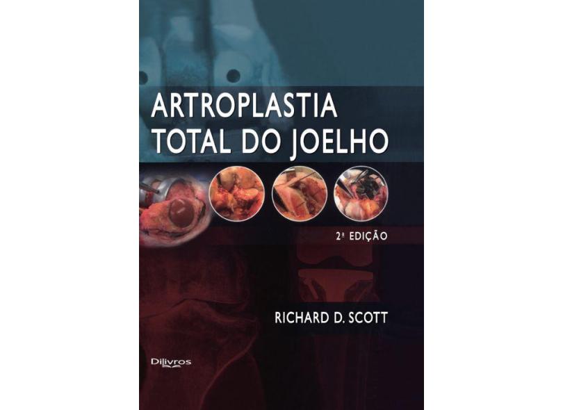 ARTROPLASTIA TOTAL DO JOELHO - Scott, Richard D - 9788580531039