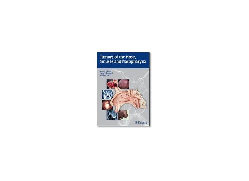 TUMORS OF THE NOSE, SINUSES AND NASOPHARYNUX - Lund - 9783131471918