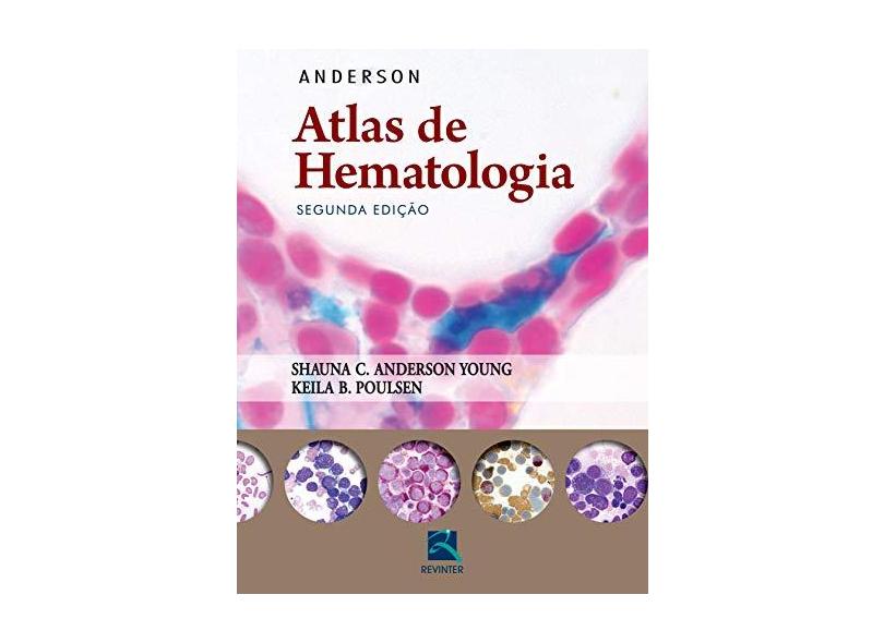 Anderson: Atlas de Hematologia - Anderson Young - 9788537206409