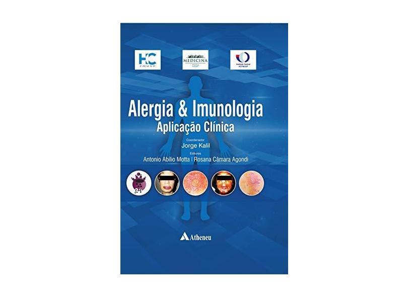 Alergia e Imunologia - Aplicação Clínica - Kalil Filho, Jorge Elias - 9788538806653