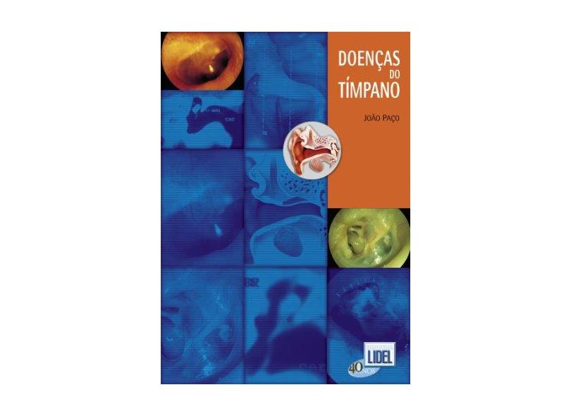 Doenças do Tímpano - João Paço - 9789727572717