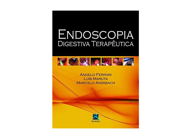 Endoscopia Digestiva Terapeutica - Capa Comum - 9788537204382